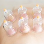 dr_umer_cupping_session